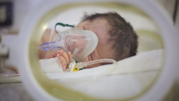 Bebês prematuros com vírus sincicial respiratório